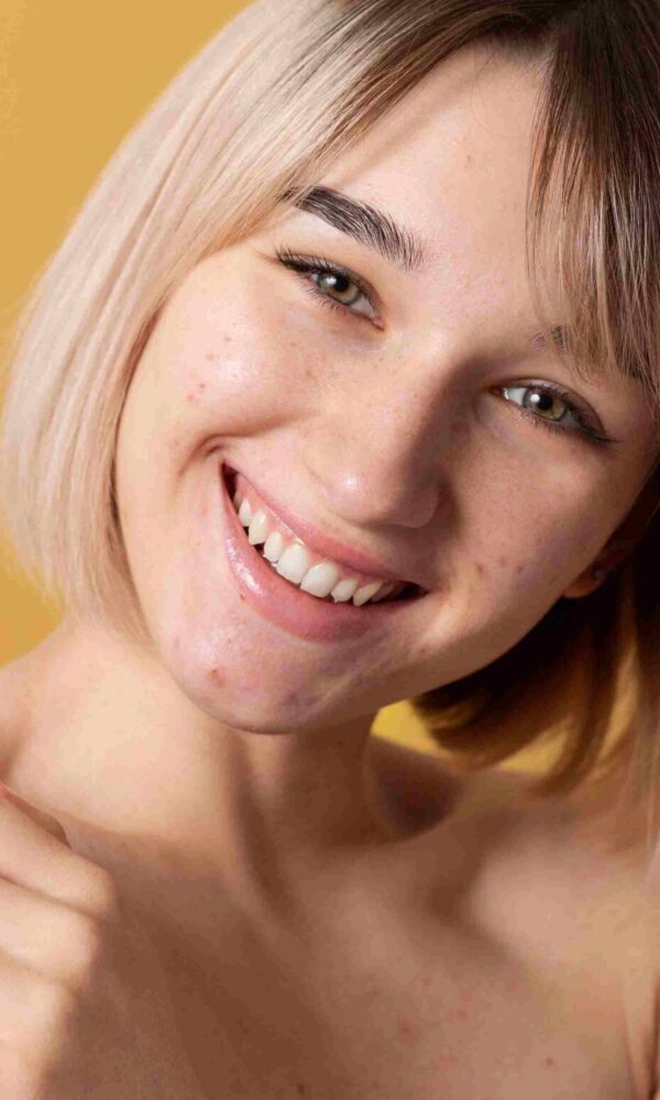 penyebab muncul jerawat di area wajah